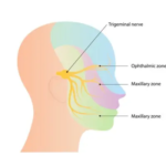 Trigeminal Neuralgia