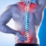 Recovery Tips After Minimal Invasive Spine Surgery